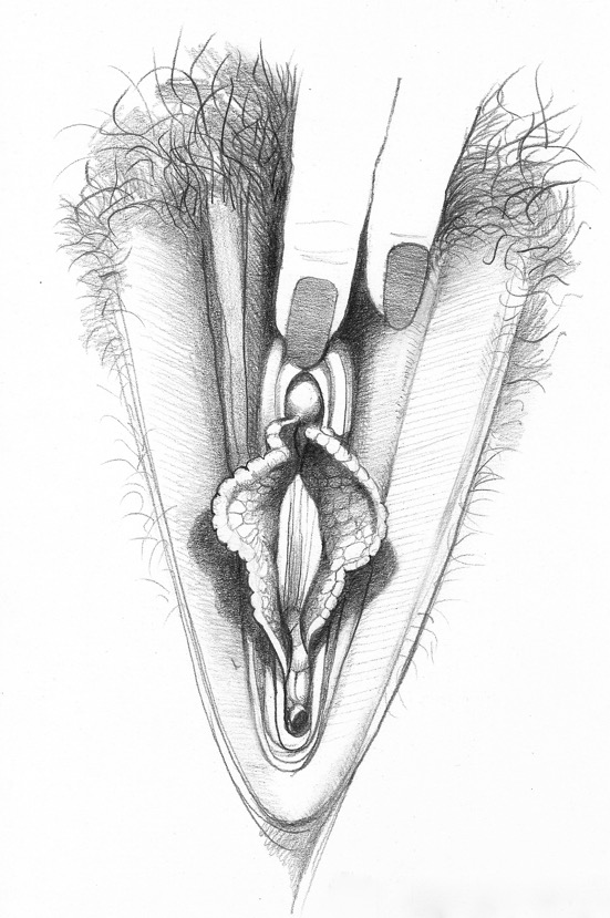 Classical Vulva